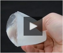 Gummy Bear Breast Implant Retention Video